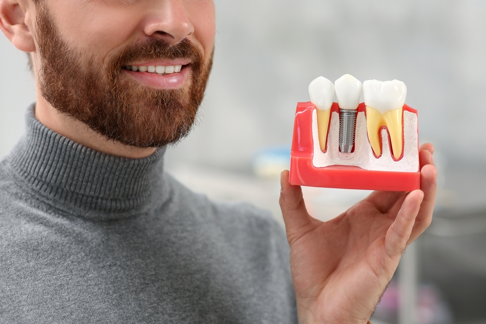 Man,holding,educational,model,of,dental,implant,on,blurred,background,