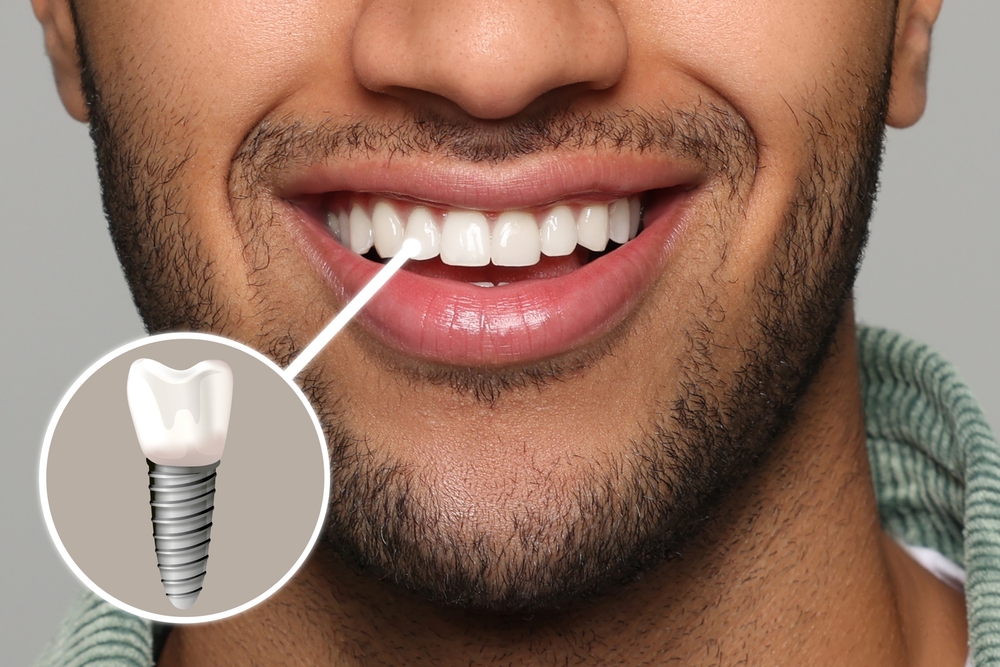 Happy,man,with,perfect,teeth,smiling,on,grey,background,,closeup.